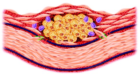 inflammation-and-atherosclerosis inflammation-and-atherosclerosis
